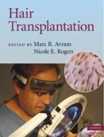 Hair transplantation /