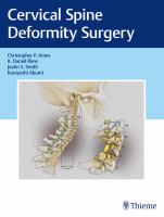 Cervical spine deformity surgery /