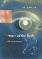 Pictures of the body : pain and metamorphosis /