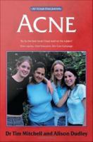 Acne : the "at your fingertips" guide /